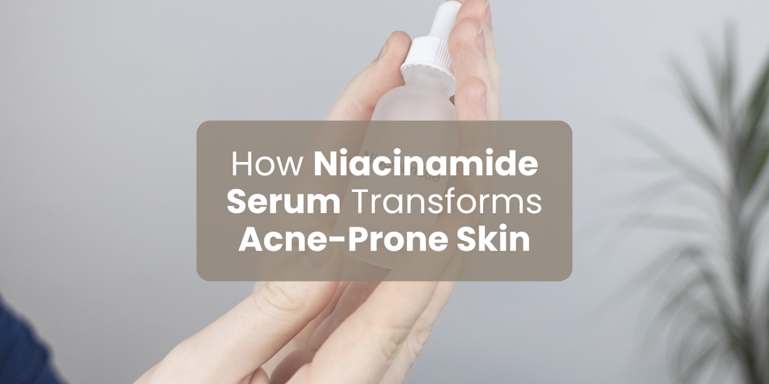 How Niacinamide Serum Transforms Acne-Prone Skin