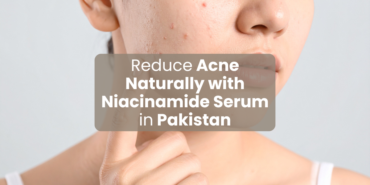 Reduce Acne Naturally with Niacinamide Serum in Pakistan