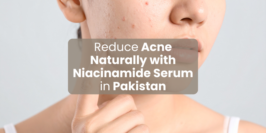 Reduce Acne Naturally with Niacinamide Serum in Pakistan