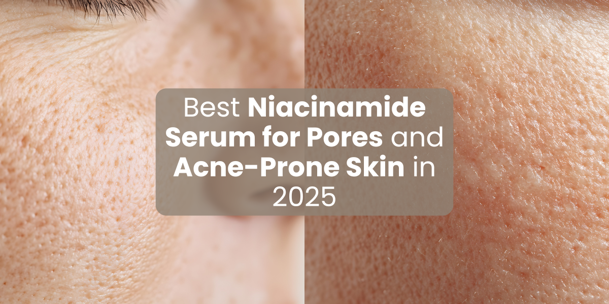 Best Niacinamide Serum for Pores and Acne-Prone Skin in 2025