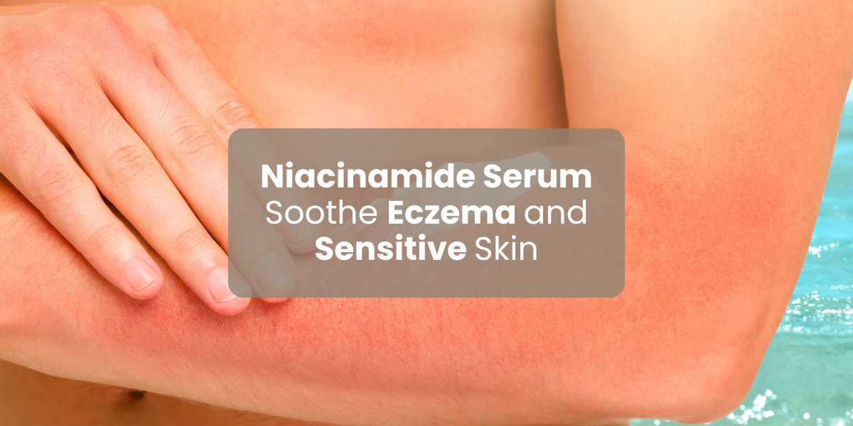 Can Niacinamide Serum Soothe Eczema and Sensitive Skin?