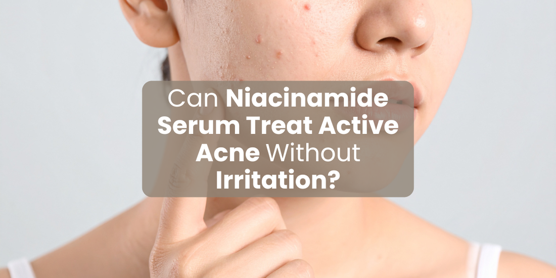 Can Niacinamide Serum Treat Active Acne Without Irritation?