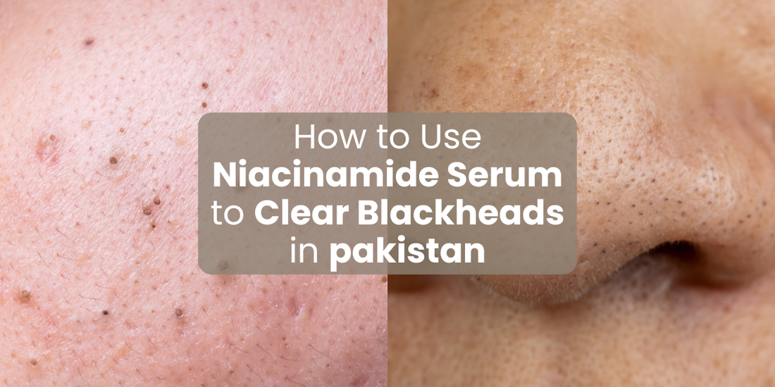 How to Use Niacinamide Serum to Clear Blackheads in pakistan