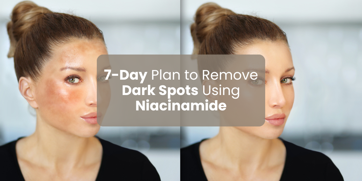 7-Day Plan to Remove Dark Spots Using Niacinamide