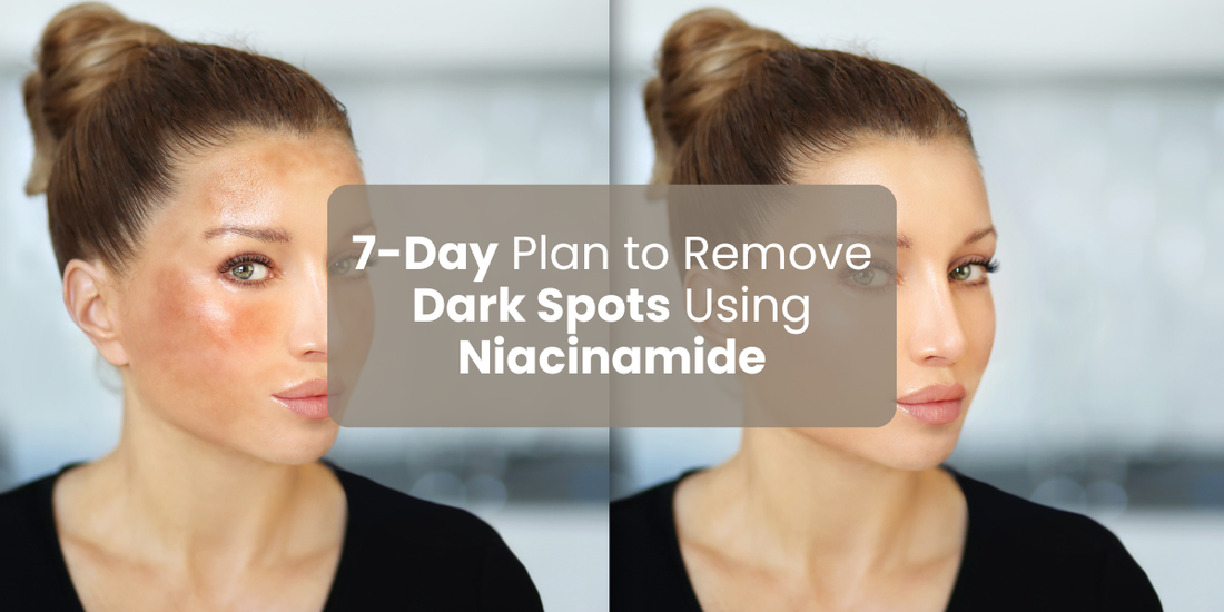 7-Day Plan to Remove Dark Spots Using Niacinamide