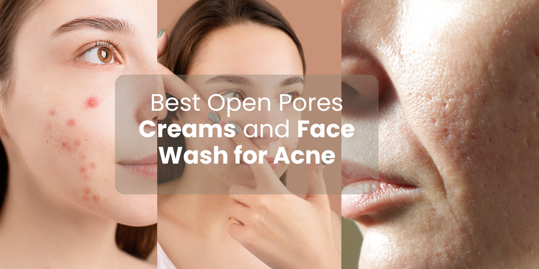 Effective Open Pores Cream and Acne Face Wash in Pakistan 2025